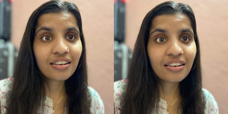 कृतिम आँखा लगाएपछि चस्माबिना यस्तो देखिइन् गायिका मेनुका पौडेल