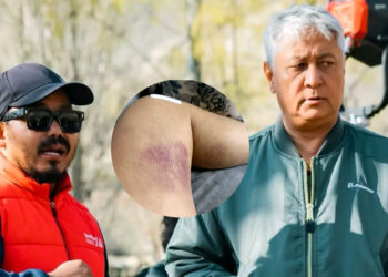 ‘सुम्निमा’ को सेटमा घाइते हुँदा विजय लामा रोएपछि भावुक बने निर्देशक मिलन चाम्स