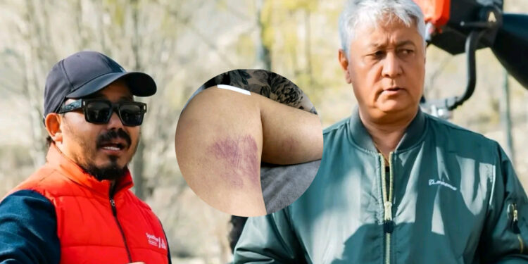 ‘सुम्निमा’ को सेटमा घाइते हुँदा विजय लामा रोएपछि भावुक बने निर्देशक मिलन चाम्स